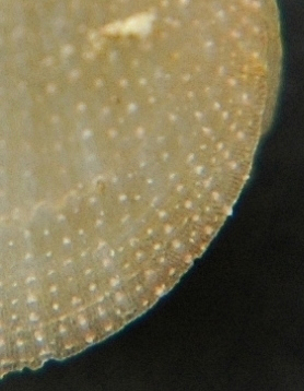microsculpture striatum